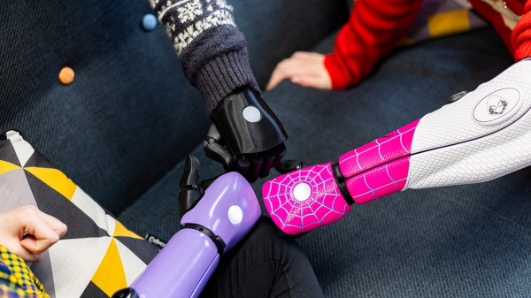 'Best Christmas gift' ever as kids with missing limbs receive bionic arms: 'Amazing'