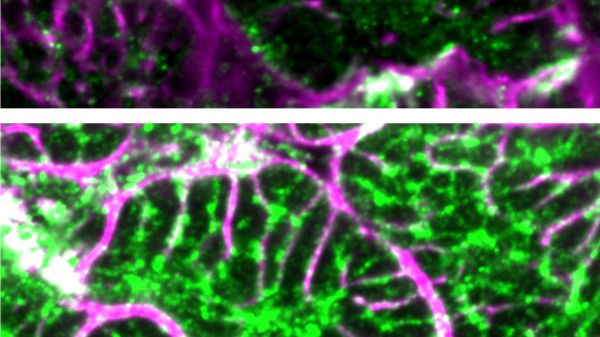 Heart failure is reversed with new gene therapy in animal study: &lsquo;Unprecedented recovery&rsquo;