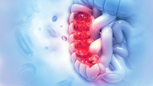 Cooking oil linked to colon cancer in early study, tied to inflammation