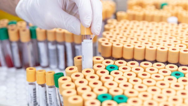 CDC monitoring possible spike of HMPV cases in China