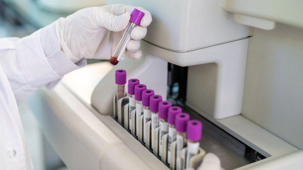 Deadly virus samples went missing from lab in &lsquo;major biosecurity breach,&rsquo; say authorities