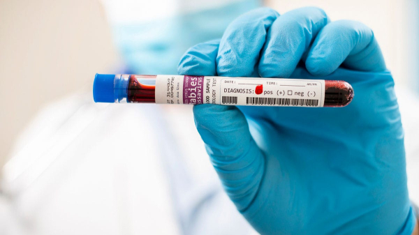 Deadly virus samples went missing from lab in &lsquo;major biosecurity breach,&rsquo; say authorities