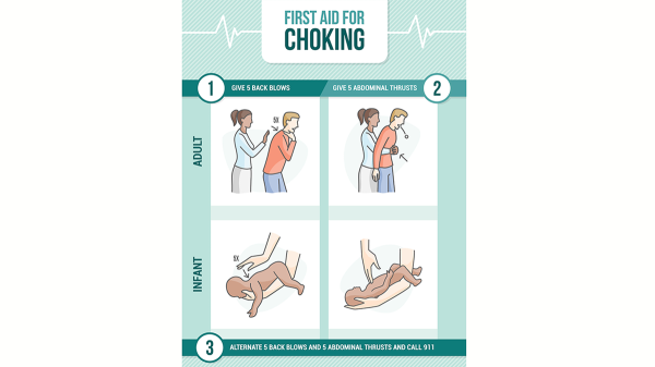 Choking emergency? How to do the Heimlich maneuver &mdash; and when to avoid it