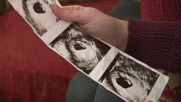 Artificial intelligence could help more women get pregnant via IVF