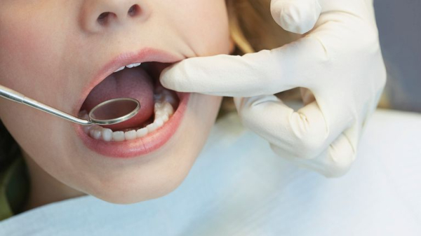 Dentist reveals how you can earn up to &pound;150k - and what he's really thinking when he's looking in your mouth