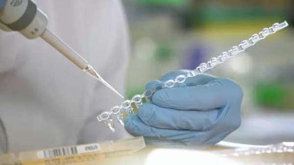 Doctors look for clues on why 'super survivors' overcome cancer in first global study