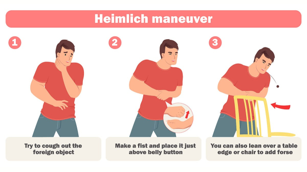 Choking emergency? How to do the Heimlich maneuver &mdash; and when to avoid it