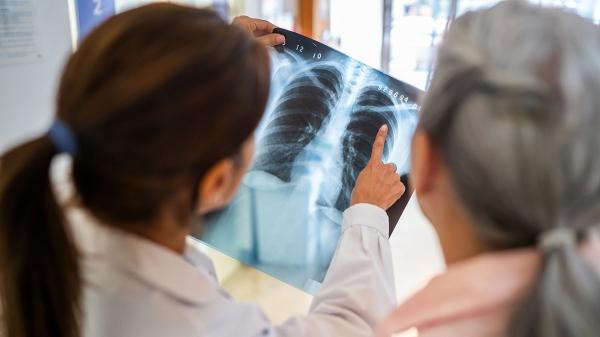 Doctors say eating specific type of food may offset lung damage from air pollution Doctors say eating specific type of food may offset lung damage from air pollution